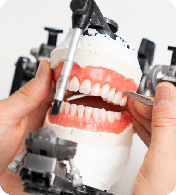 Prothèse dentaire complète amovible